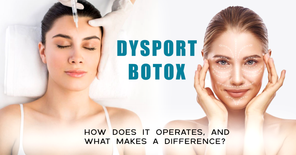 Botox Vs Dysport A Comprehensive Comparison